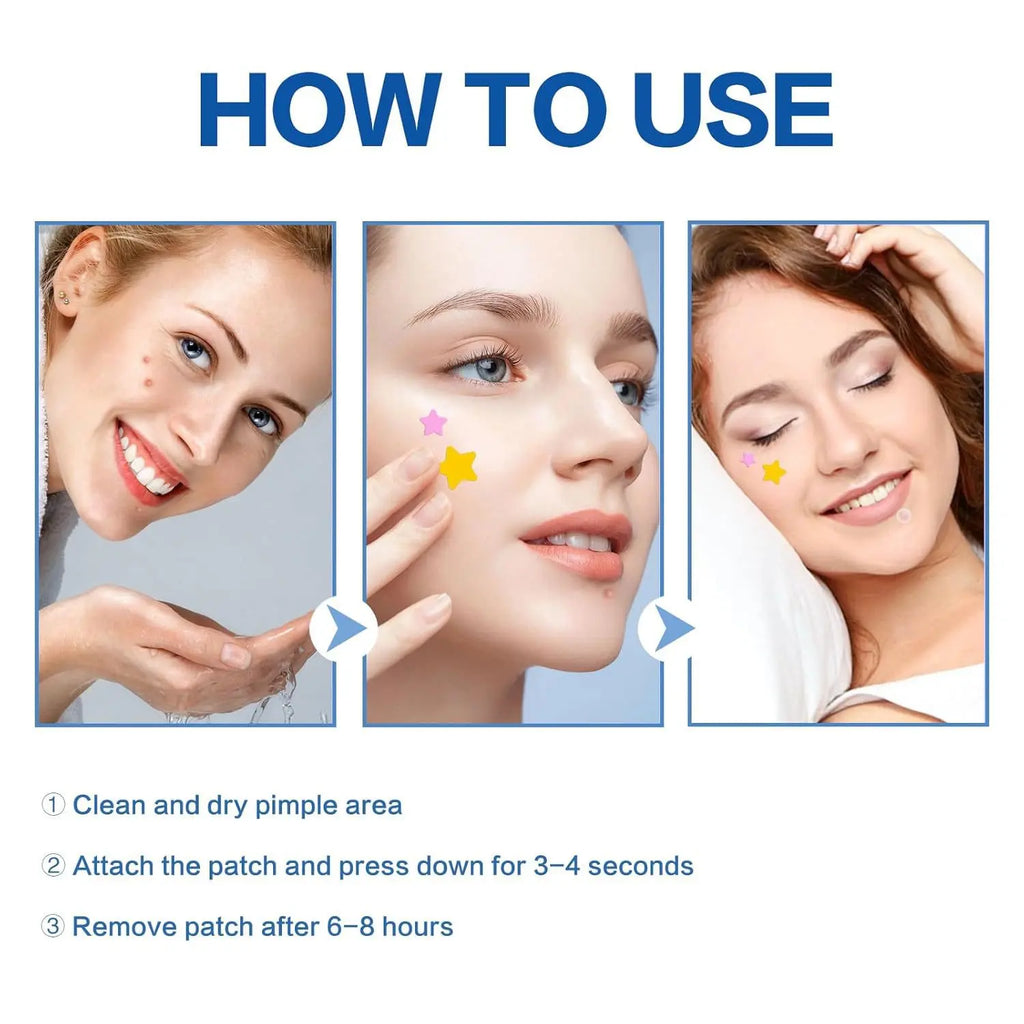 560Pcs Star Hydrocolloid Acne Patches — 7 Colors, Invisible Blemish Spot Stickers
